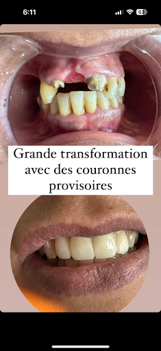 travail du dr anouer taboui