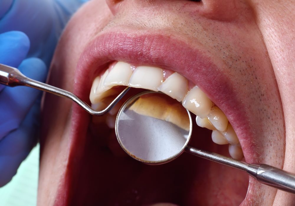 Examen dentaire complet